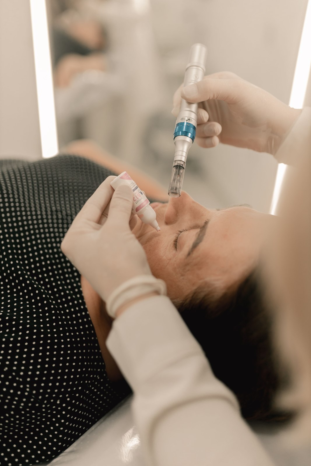 Microneedling — representative stock photography