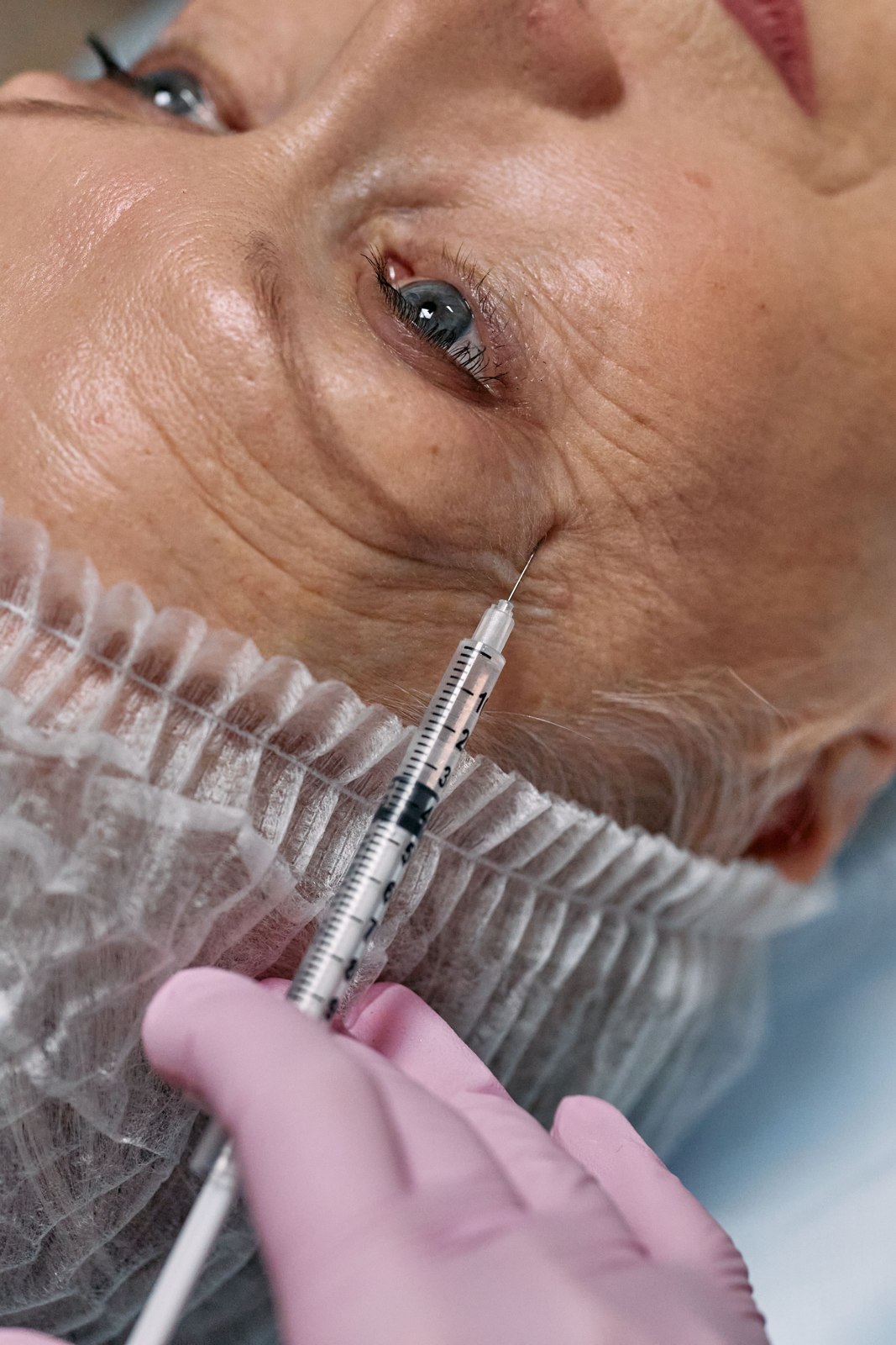 Wrinkle Relaxers — representative stock photography